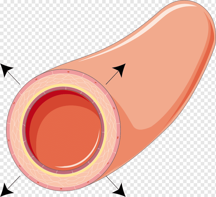 All the following are events of early inflammation except